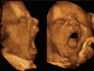 fetal-yawn2.gif